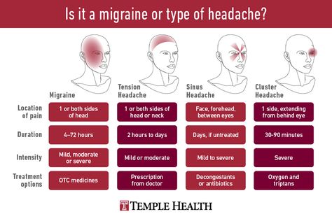 Migraine Vs Headache, Headache Location, Migraine Triggers, Med Surg Nursing, Doctor Help, Migraine Attack, Migraine Pain, Migraine Prevention, Headache Types