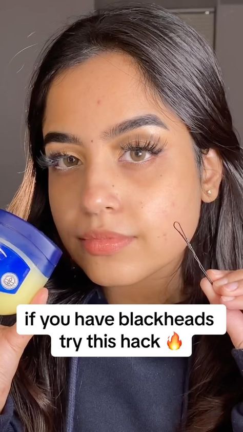 Doro Cubillo | if you have blackheads try this method to remove them: 💦 with clean skin apply @vaselinebrand on the areas that you see blackheads 💦 then... | Instagram Black Head Removal Diy, Best Way To Remove Blackheads, How To Get Rid Of Blackheads On Nose, Removing Blackheads From Nose Videos, Black Head Removal Video Nose, Neck Pimples, How To Treat Blackheads, Blackheads On Cheeks, Skin Glow Tips