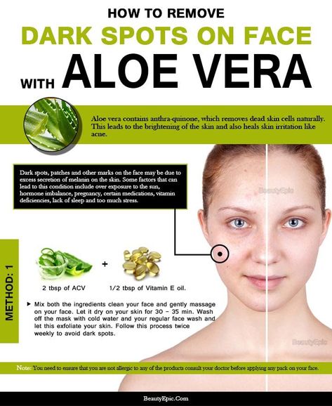 aloe vera for dark spots on face For Dark Spots On Face, Dark Spots On Legs, Facial Exercise, Aloe Vera For Skin, Skin Care Routine For 20s, Face Cleaning, Dark Spots On Face, Crochet Angels, Tighten Skin