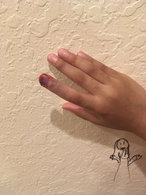 Hello I’m Praneel do you see this picture I broke my finger Broken Makeup, Broken Finger, Long Natural Nails, Painting Halloween, Fever Dream, Amazing Halloween Makeup, Face Painting Halloween, New Photo Download, Photo Download