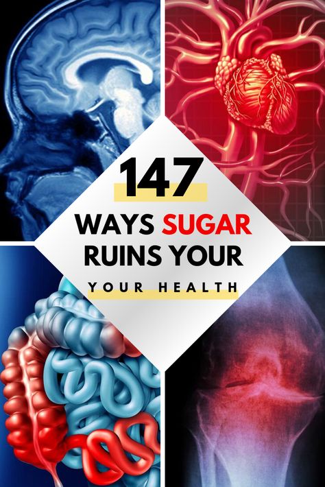 Effects Of Sugar, Sugar Effect, High Blood Sugar Levels, 3 Day Detox, Quit Sugar, Detox Tips, Probiotic Foods, Ate Too Much, Cleanse Your Body