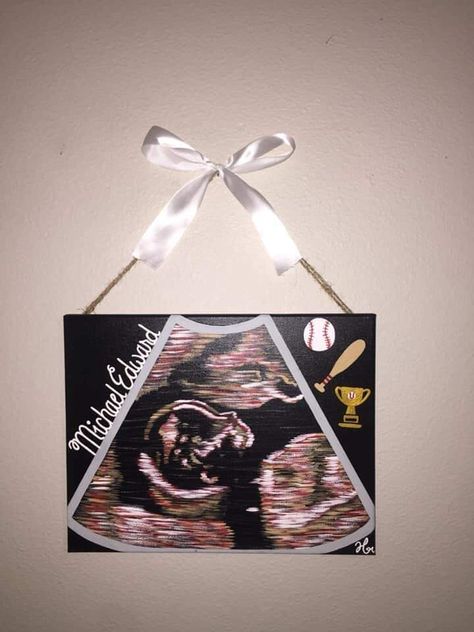 Ultrasound Picture Ideas Display, Ultrasound Picture Ideas, Ultrasound Painting, Boy Nurseries, Scrapbook Photos, Baby Ultrasound, Pregnancy Art, Ultrasound Pictures, Nursery Paintings