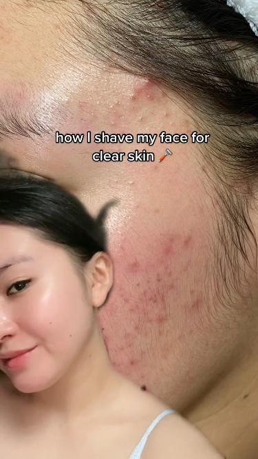 Shave Your Face, Hydra Moist, Beginner Skin Care Routine, Diy Skin Care Routine, Natural Face Skin Care, Serious Skin Care, Night Skin Care Routine, Dermatological Skin Care, Clear Skin Tips