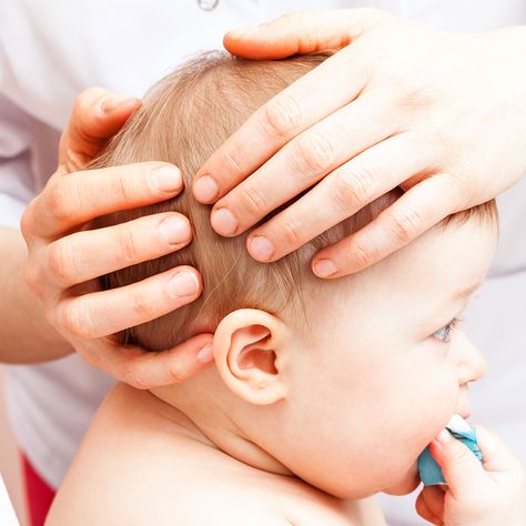 As a parent I understand how it's nice to help clear up your baby's scalp. Here's some information about how to get rid of cradle cap with a natural remedy. Baby Head Shape, Flat Head Syndrome, Roman Chamomile Essential Oil, Diy Medicine, Flaking Skin, Extremely Dry Skin, Cradle Cap, Diaper Rash Cream, Rash Cream