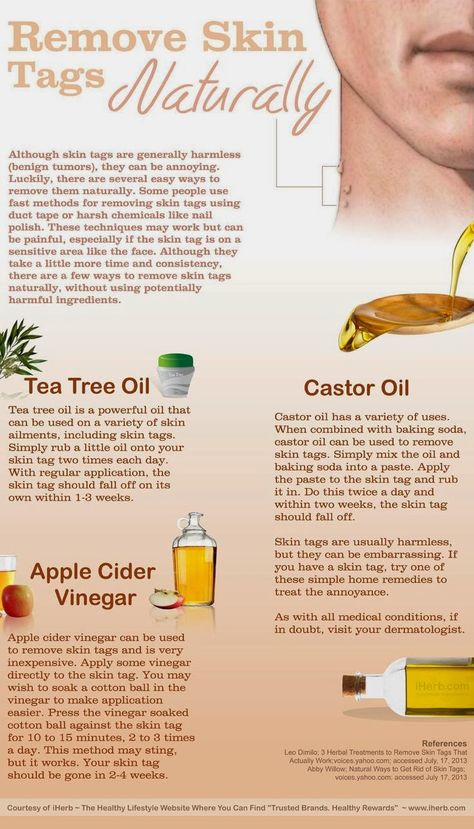 Apple Cider Vinegar For Skin, Remove Skin Tags Naturally, Remove Skin Tags, Skin Moles, Cold Sores Remedies, Skin Tags, Natural Cold Remedies, Glow Skin, Natural Cough Remedies