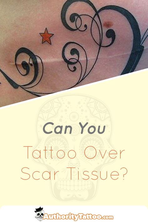 Process Tattoo, Tattoo Over Scar, Learn To Tattoo, Tattoo Tips, Tattoos To Cover Scars, Tattoo Practice, Scar Tattoo, Healing Tattoo, Tattoo Care