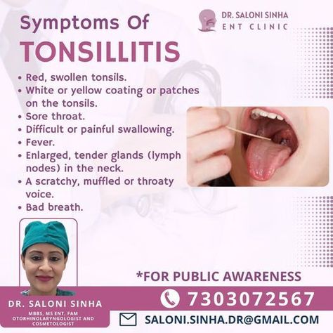 Swollen Tonsils, Cosmetic Clinic, Fat Burning Tips, Lymph Nodes, Health Planner, Sore Throat, Self Help Books, Health And Fitness Tips, Holistic Health