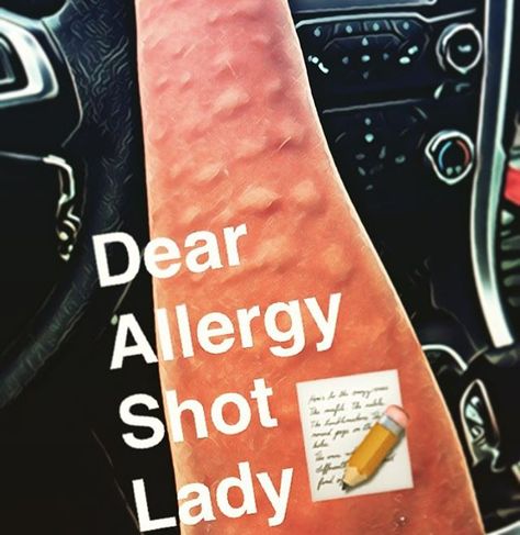 My experience getting allergy shots Allergy Testing Skin, Allergy Symptoms Signs Seasonal, Allergy Awesomeness, Allergy Shots, Seasonal Allergy Symptoms, Allergy Asthma, Allergies, Health