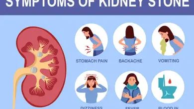 This Powerful, Yet Delicious Juice Removes Kidney Stones & Gallstones From Your Body Naturally (Recipe Included) - Green Living Tribe Kidney Stone Relief, Parathyroid Disease, Renal Calculi, Differential Diagnosis, Kidney Pain, Kidney Stone, Uric Acid, Kidney Health, Stomach Pain