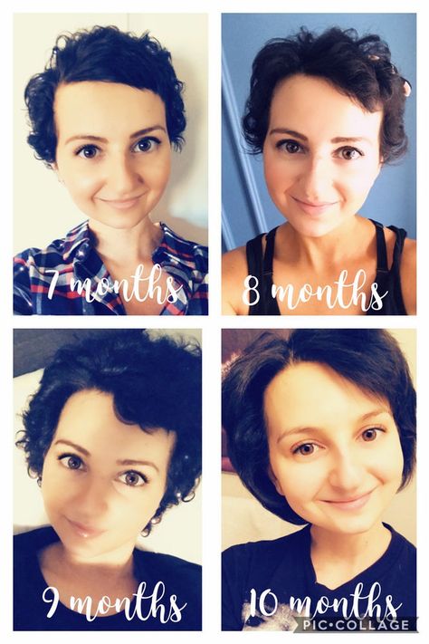 Let it Grow: Tips for Post-Chemo Hair Growth! Styling Hair After Chemo, Chemo Curls Hairstyles, Tips For Growing Out Hair, Growing Hair After Chemo, One Year Hair Growth, Hair After Chemo, Chemo Curls, Hair Growth After Chemo, Full Thick Hair