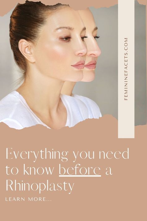 Rhinoplasty recovery tips, nose job timeline & what to know before getting a nose job (rhinoplasty) ♥ Before and After nose job | Rhinoplasty recovery tips| Nose job recovery Rhinoplasty Recovery Tips, Nose Jobs Before And After, Nose Job Before And After Rhinoplasty, Rhinoplasty Before After, Rhinoplasty Recovery Timeline, Nose Job Before And After, Nose Job Recovery, Before And After Nose Job, Biggest Insecurities