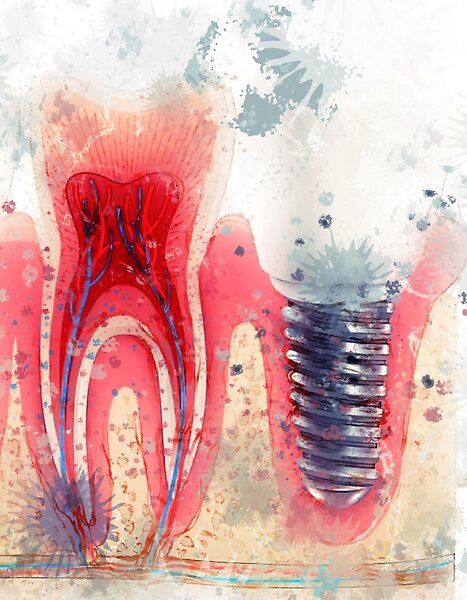 Conservative And Endodontics Art, Dentistry Art Painting, Dental Painting, Dentistry Art, Dental Wall Art, Dental Pictures, Dental Wallpaper, Dental Business Cards, Dentist Art