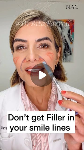 Mid Cheek Filler, Cheek Fillers Before And After, Mid Face Filler, Cheek Filler Before And After, Face Fillers Before And After, Fillers Before And After, Cheek Fillers Before And After Face, Botox Before And After, Face Fillers