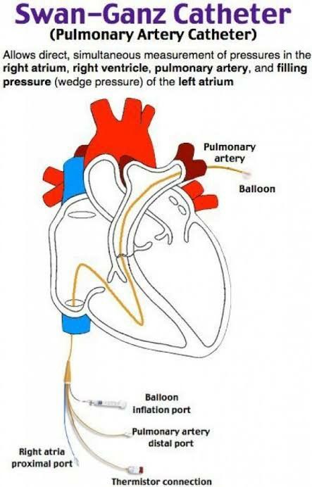 Cath Lab Nursing, Cath Lab Nurse, Cardiac Cath, Heart Catheterization, Cvicu Nursing, Nursing Fun, Nursing Assessment, Nursing Mnemonics, Nurse Study Notes