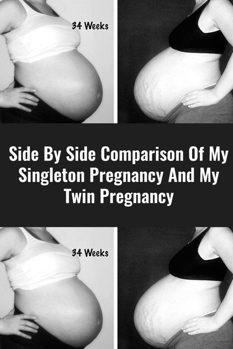 Side By Side Comparison Of My Singleton Pregnancy And My Twin Pregnancy Twin Belly, Twin Pregnancy Belly, Types Of Twins, Placenta Encapsulation, Twin Tattoos, Parent Tattoos, Pregnancy Belly, Parents Quotes Funny, Polycystic Ovarian Syndrome