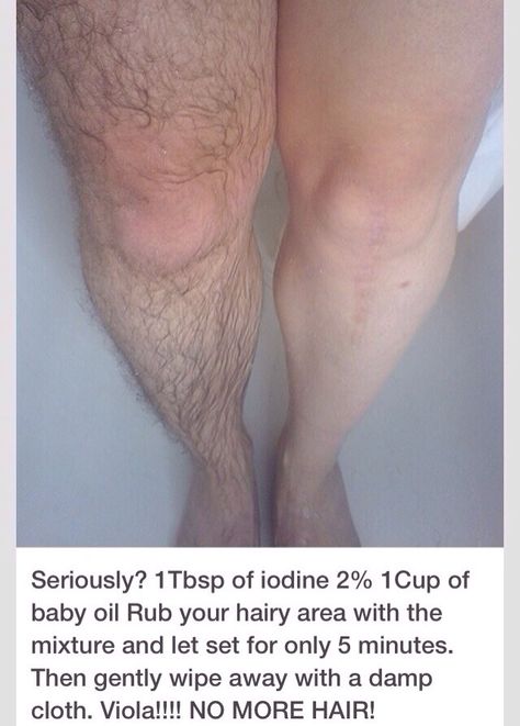 Remove Leg Hair WITHOUT Shaving! Simply Soak Your Legs #Fashion #Beauty #Trusper #Tip To Good To Be True, Remove Hair, Unwanted Facial Hair, Beauty Remedies, Unwanted Hair Removal, Unwanted Hair, Marriage Tips, Homemade Beauty Products, Skin Tips