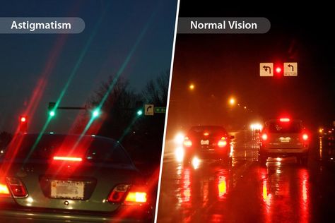 Astigmatism Vision At Night, Astigmatism Vision, Astigmatism Eye, Learning Disorder, Lasik Surgery, Parts Of The Eye, Laser Surgery, Blurry Vision, Eye Chart