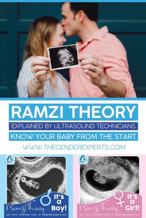 Baby Heart Rate Gender Prediction, Sonogram Gender Prediction, Ramsey Theory Baby Gender, Baby Heartbeat Gender Prediction, 6weeks Pregnant Ultrasound, Week 6 Of Pregnancy, 8weeks Pregnant Ultrasound, Anterior Placenta Gender Prediction, Fetal Heart Rate Gender