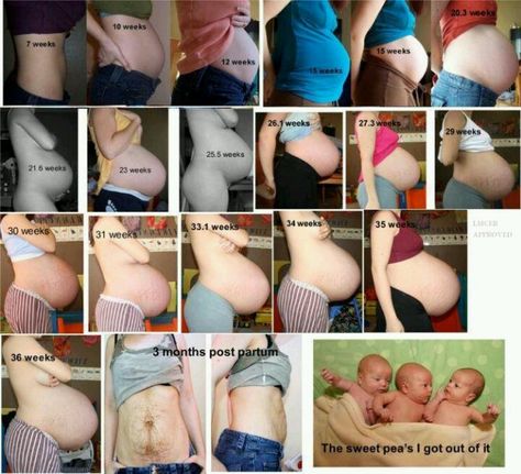 Amazing! Watch this mom's bump grow and shrink with her triplets! #triplets #multiples #bump Pregnant With Triplets Belly, 6 Week Baby, Bump Progression, Twin Belly, Baby Bump Progression, Triplets Pregnancy, Multiples Baby, Triplet Babies, Twin Pregnancy