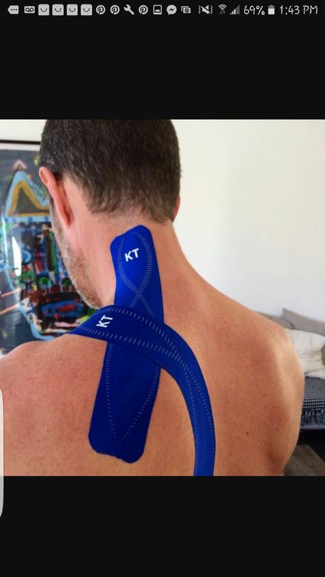 Kinesio taping method for Cervical dystonia Facitis Plantar, Levator Scapulae, K Tape, Kt Tape, Kinesio Taping, Tape Ideas, Feel Energized, Sports Tape, Kinesiology Taping