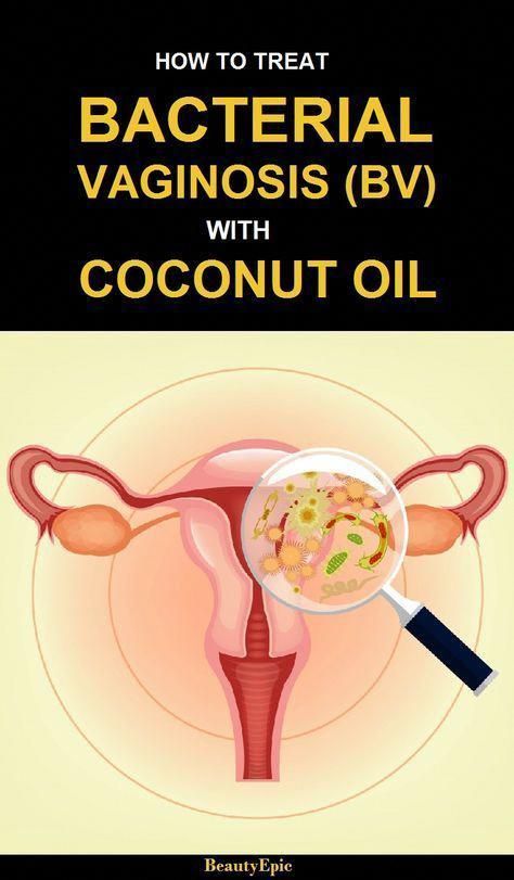 How to Get Rid of Bacterial Vaginosis with Coconut Oil #GreenCoffeeBeanWeightLossPills #BestHealthTips Best Cough Remedy, Coconut Oil Beauty, Healthy Diet Tips, Natural Cough Remedies, Cough Remedies, Daily Health Tips, Good Health Tips, Health And Fitness Tips, Herbal Remedies