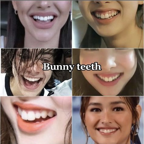 Bunny Teeth Aesthetic, Pretty Teeth Smile Aesthetic, Bunny Beauty Face, Pretty Teeth Black Women, Bunny Teeth Smile, Bunny Pretty Face Aesthetic, Bunny Pretty Face, Aesthetic Teeth Smile, Bunny Teeth Smile Girl