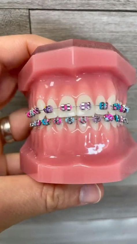 Braces Colors Combinations, Braces Ideas, Braces Colors Ideas, Cute Braces Colors, Braces Tips, Getting Braces, Health Aesthetic, Cute Braces, Brace Face