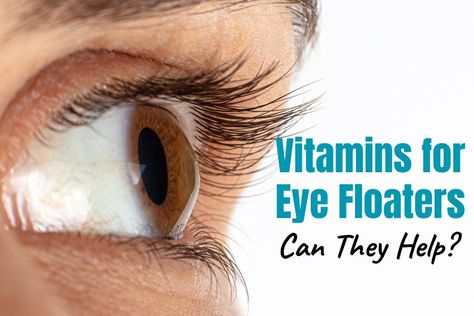 vitamins for eye floaters Eye Floaters Remedies, Floaters In The Eye, What Causes Eye Floaters, Eye Health Facts, Eye Floaters Causes, Eye Health Remedies, Eye Health Food, Eye Floaters, Eye Twitching