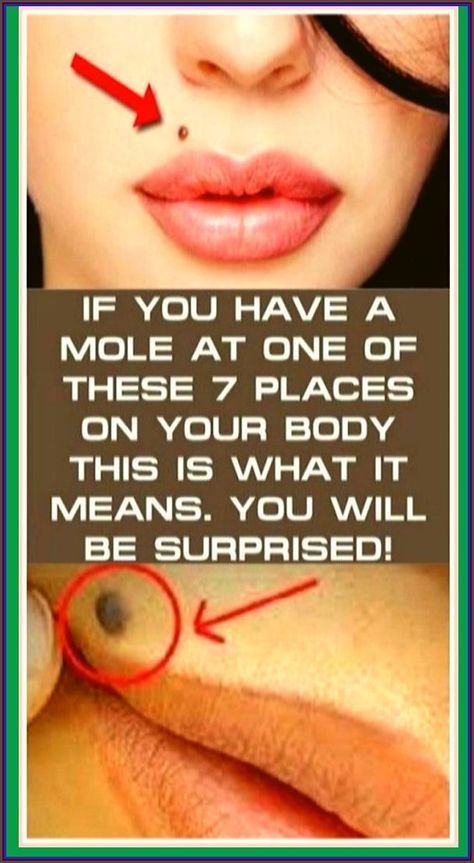 IF YOU HAVE A MOLE AT ONE OF THESE 7 PLACES ON YOUR BODY THIS IS WHAT IT MEANS. YOU WILL BE SURPRISED Mole Meaning, Heart Diet, Women Health Care, Healthy Advice, Baking Soda Shampoo, School Communication, Face Wrinkles, Health Planner, Health Dinner