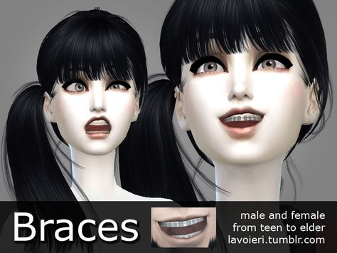 - 5 color variations; Found in TSR Category 'Sims 4 Female Skin Details' Sims 4 Cc Accessories, Kids Braces, Sims 4 Blog, Sims 4 Skin, Sims 4 Tsr, Sims 4 Studio, Sims 4 Cc Shoes, Sims Custom Content, Female Sims