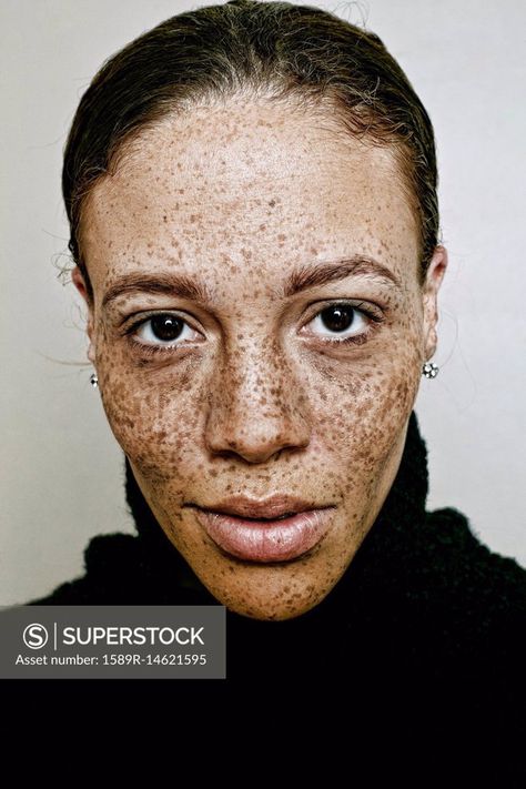 Close Up Of Serious Mixed Race Woman Mixed Race Woman, Human Race Skincare, Mixed Race Black Women, Women Of Different Races Photography, Black Freckles Woman, Natural Women, Photography Women, Detailed Image, Stock Photography