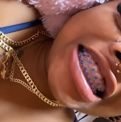 dα вrαt🧞‍♀️. Gold Braces With Color Bands, Dark Skin With Braces, Braces Aesthetic Girl, Braces With Rubber Bands, Braces Black Women, Brace Ideas, Braces Colours, Power Chain Braces, Dental Braces Colors