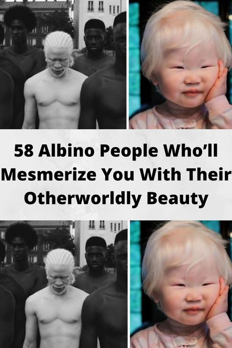 58 #Albino People Who’ll #Mesmerize You With Their Otherworldly #Beauty Albino People, Makeup Fails, Spotlight Stories, Wife Jokes, Celebrity Halloween Costumes, Prom Photos, Celebrity Trends, Photo Series, Random Acts Of Kindness