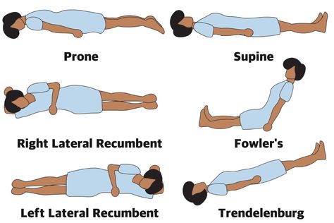 Anatomical position describes the orientation of a body or body parts. Learn the most common anatomical positions with this illustrated guide. Anatomical Position, Emt Study, Medical Assistant Student, Radiology Student, Medical Sales, Basic Anatomy And Physiology, Nurse Study Notes, Nursing School Survival, Fundamentals Of Nursing