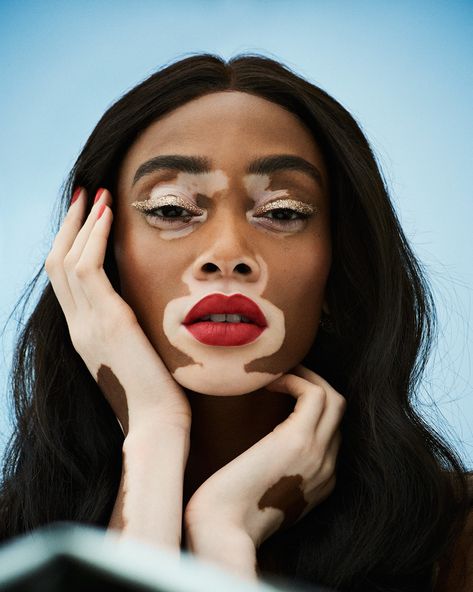 Winnie Harlow in Grazia UK June 25th, 2018 by Jason Hetherington Face Drawing Reference, Winnie Harlow, Human Reference, Face Photography, Arte Inspo, Art Style Inspiration, Portrait Inspiration, Interesting Faces, Photo Reference