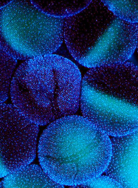 Wellcome Images, Yves Klein Blue, Shocking Blue, Kind Of Blue, Whatsapp Wallpaper, Photo Awards, Science Photos, Colour Board, Feeling Blue