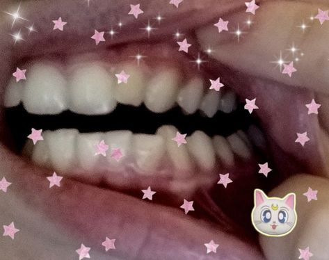 Insisors and More on Instagram: “holy shit. after a year of waiting, i’m finally getting my wisdom teeth removed next week ~ #teeth #teethcore #dirtcore #pinkcore…” Creepy Cute Aesthetic, Requiem For A Dream, Dreamcore Weirdcore, Theme Color, Creepy Cute, Art Reference, We Heart It, Hello Kitty, Kitty