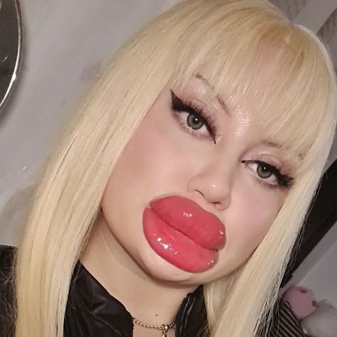 Huge Lip Fillers, Big Lips Funny, Bad Lip Filler, Big Lips Girl, Art Pictures Ideas, Funny Lips, Female Lips, Fake Lips, Beetlejuice Halloween