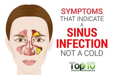 Sinusitis: 8 Symptoms That Indicate a Sinus Infection Sinus Infection Symptoms, Acute Sinusitis, Remedy For Sinus Congestion, Upper Respiratory Tract, Sinus Remedies, Home Remedies For Sinus, Sinus Congestion Relief, Sinus Infection Remedies, Top 10 Home Remedies