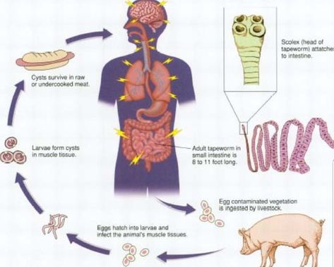 Tape Worm In Humans, Worms In Humans, Brain Tissue, Bile Duct, Diagram Design, Muscle Tissue, The Human Body, Life Cycle, Health Facts