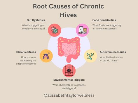 🌸 𝑪𝒉𝒓𝒐𝒏𝒊𝒄 𝑯𝒊𝒗𝒆𝒔? 5 𝑯𝒊𝒅𝒅𝒆𝒏 𝑪𝒂𝒖𝒔𝒆𝒔 𝑩𝒆𝒍𝒐𝒘 🌸 Chronic hives can be frustrating and perplexing. One day your skin is clear then the next, you’re dealing with uncomfortable, itchy welts that seem to appear out of nowhere. If this is you, you’re not alone, and it’s not just in your head! Hives are the result of something deeper occurring in the body. While conventional approaches focus on symptom relief, addressing the underlying causes is crucial for long term solutions. Some of the most common c... Hives Causes, Types Of Skin Rashes, Hives Remedies, Chronic Hives, Soothing Face Mask, Skincare For Oily Skin, Out Of Nowhere, Acne Solutions, Sensitive Skin Care