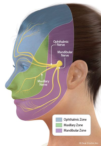 Trigeminal Neuralgia - A Nerve Disorder That Causes Facial Pain Facial Muscles Anatomy, Nerve Anatomy, Nerve Disorders, Facial Anatomy, Dental Hygiene School, Facial Nerve, Basic Anatomy And Physiology, Jaw Pain, Human Body Anatomy