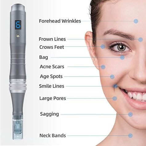 Microneedling Pen, Derma Rolling, Micro Needle Roller, Derma Pen, Derma Roller, Scar Removal, Acne Spots, Skin Care Kit, Skin Discoloration