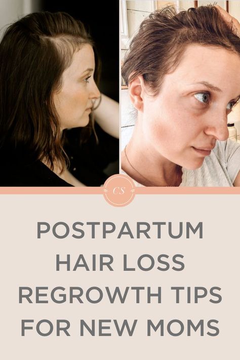 Postpartum hair loss regrowth can feel like a difficult challenge.  Take a look at my effective postpartum hair regrowth tips and other postpartum care recovery advice here! Post Partum Bangs, Hairstyles To Hide Regrowth, Best Postpartum Haircut, Hairstyles For Postpartum Hair, Post Partum Hairloss Remedy, Haircut For Postpartum Hair, Postpartum Haircut Ideas, Postpartum Haircut For Fine Hair, Postpartum Hair Shedding