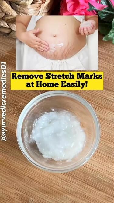 Beginner Skin Care Routine, Haut Routine, Natural Skin Care Ingredients, Clear Healthy Skin, Natural Skin Care Remedies, Diy Skin Care Routine, Natural Face Skin Care, Stretch Mark Removal, Good Skin Tips