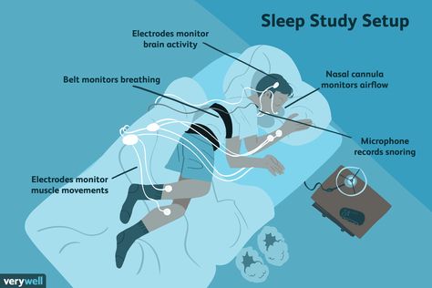 Study Setup, Snoring Remedies, Fetal Position, Sleep Study, Blue Cross Blue Shield, How To Stop Snoring, Sleep Studies, When You Sleep, Study Test