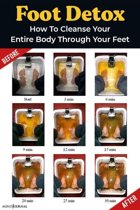 visit our blog for Homemade Foot Pads To Detox Your Body Overnight How Can You Make Them Foot Detox Soak, Foot Soak Recipe, Full Body Detox, Detox Bath, Detoxify Your Body, Healthy Liver, Cleanse Your Body, Body Detox, Detox Your Body