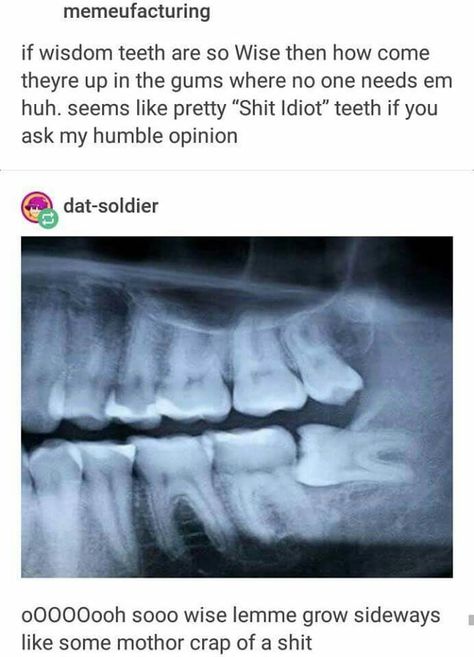 Wisdom Teeth Meme, Wisdom Teeth Quotes, Wisdom Teeth Funny, Dental Bridge, Canine Art, Dimension 20, Wisdom Teeth, College Humor, Watch New