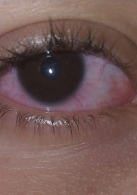 Red High Eyes, Rauch Fotografie, Crying Eyes, Bff Hands Aesthetic, Dont Touch My Phone Wallpaper, Eye Pictures, Photos Of Eyes, Pics For Dp, Hand Pictures