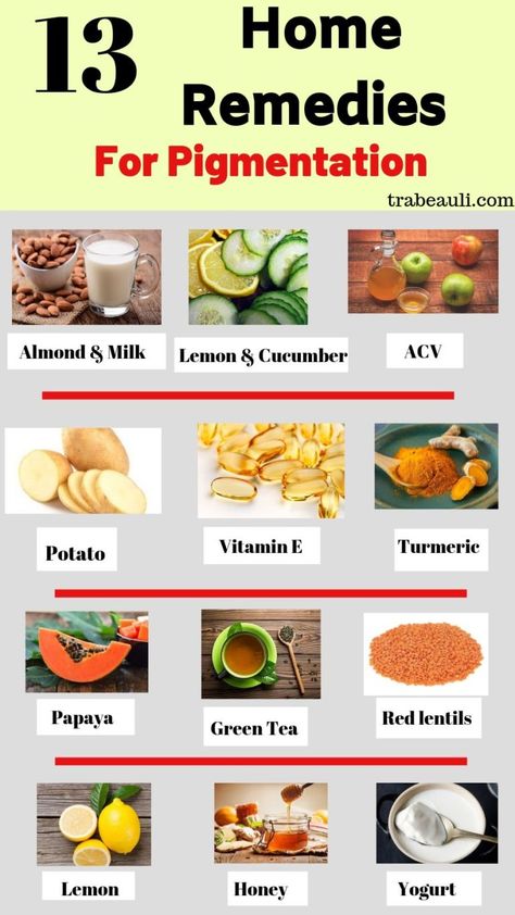 Pigmentation Remedy, Potato For Skin, Lemon Juice Face, Potato Face, Green Tea Lemon, Home Remedies For Skin, Dark Spots On Face, Dark Spots On Skin, Spots On Face